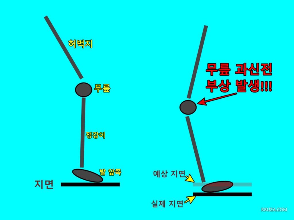 단차, 턱 없이 평평한 복도인 줄 알고 걸었을 때, 갑자기 낮은 지면에 발이 착지하게 되면서 생길 수 있는 부상인 무릎 과신전에 대해서 표현한 그림입니다.